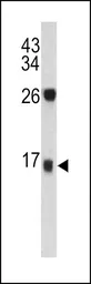 Anti-DCD antibody, C-term used in Western Blot (WB). GTX81756