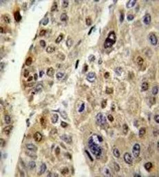 Anti-Antithrombin III antibody, C-term used in IHC (Paraffin sections) (IHC-P). GTX81758