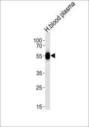 Anti-Antithrombin III antibody, C-term used in Western Blot (WB). GTX81758