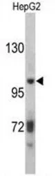 Anti-Antithrombin III antibody, C-term used in Western Blot (WB). GTX81758