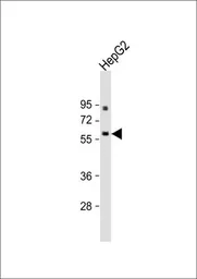 Anti-ANGPTL3 antibody, N-term used in Western Blot (WB). GTX81760