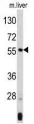 Anti-ANGPTL3 antibody, N-term used in Western Blot (WB). GTX81760