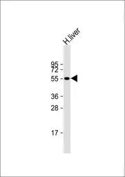 Anti-CYP2C19 antibody, Internal used in Western Blot (WB). GTX81761