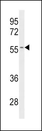 Anti-CYP2C19 antibody, Internal used in Western Blot (WB). GTX81761