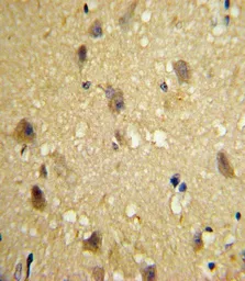 Anti-MCP1 / CCL2 antibody, C-term used in IHC (Paraffin sections) (IHC-P). GTX81767