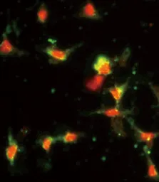 Anti-MCP1 / CCL2 antibody, C-term used in Immunocytochemistry/ Immunofluorescence (ICC/IF). GTX81767