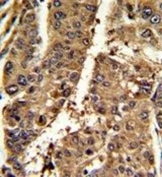 Anti-PSME2 antibody, C-term used in IHC (Paraffin sections) (IHC-P). GTX81770