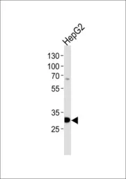 Anti-PSME2 antibody, C-term used in Western Blot (WB). GTX81770