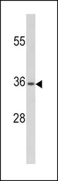 Anti-PAX4 antibody, Internal used in Western Blot (WB). GTX81771