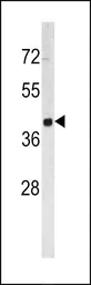 Anti-TACSTD2 antibody, Internal used in Western Blot (WB). GTX81777