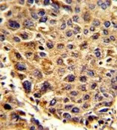 Anti-SPCS3 antibody, C-term used in IHC (Paraffin sections) (IHC-P). GTX81778