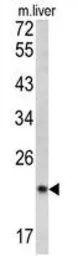 Anti-SPCS3 antibody, C-term used in Western Blot (WB). GTX81778