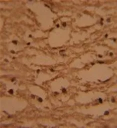 Anti-HTATSF1 antibody, N-term used in IHC (Paraffin sections) (IHC-P). GTX81789
