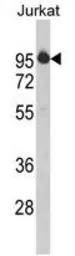 Anti-HTATSF1 antibody, N-term used in Western Blot (WB). GTX81789