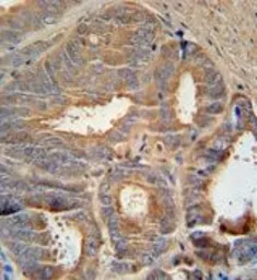 Anti-AZGP1 antibody, N-term used in IHC (Paraffin sections) (IHC-P). GTX81802