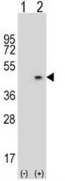 Anti-AZGP1 antibody, N-term used in Western Blot (WB). GTX81802