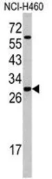 Anti-SFRS5 antibody, Internal used in Western Blot (WB). GTX81806
