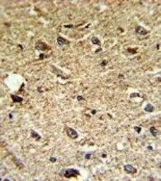 Anti-Nocturnin antibody, C-term used in IHC (Paraffin sections) (IHC-P). GTX81810