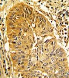 Anti-Caldesmon antibody, Internal used in IHC (Paraffin sections) (IHC-P). GTX81812
