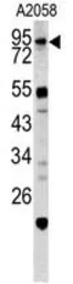 Anti-Caldesmon antibody, Internal used in Western Blot (WB). GTX81812
