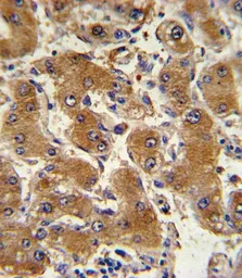 Anti-COL6A1 antibody, C-term used in IHC (Paraffin sections) (IHC-P). GTX81823