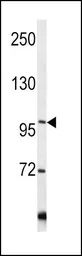 Anti-COL6A1 antibody, C-term used in Western Blot (WB). GTX81823