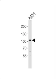 Anti-COL6A1 antibody, C-term used in Western Blot (WB). GTX81823