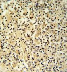Anti-Granzyme B antibody, N-term used in IHC (Paraffin sections) (IHC-P). GTX81831