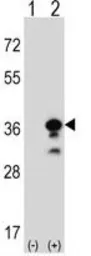 Anti-Granzyme B antibody, N-term used in Western Blot (WB). GTX81831
