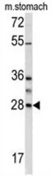 Anti-Granzyme B antibody, N-term used in Western Blot (WB). GTX81831