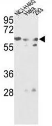 Anti-GNS antibody, Internal used in Western Blot (WB). GTX81833
