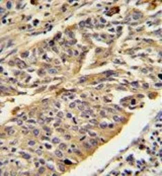 Anti-Cathepsin E antibody, Internal used in IHC (Paraffin sections) (IHC-P). GTX81837