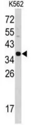 Anti-Cathepsin E antibody, Internal used in Western Blot (WB). GTX81837