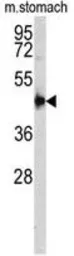 Anti-Cathepsin E antibody, Internal used in Western Blot (WB). GTX81837