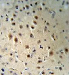 Anti-AGO1 antibody, N-term used in IHC (Paraffin sections) (IHC-P). GTX81841