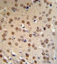 Anti-WTX antibody, Internal used in IHC (Paraffin sections) (IHC-P). GTX81847