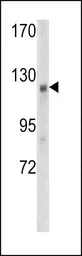 Anti-WTX antibody, Internal used in Western Blot (WB). GTX81847