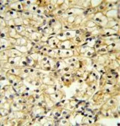 Anti-CD40L / CD154 antibody, C-term used in IHC (Paraffin sections) (IHC-P). GTX81853
