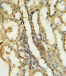 Anti-CD40L / CD154 antibody, N-term used in IHC (Paraffin sections) (IHC-P). GTX81854