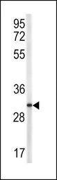 Anti-CD40L / CD154 antibody, N-term used in Western Blot (WB). GTX81854