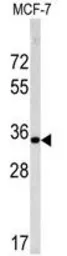 Anti-Emerin antibody, C-term used in Western Blot (WB). GTX81870
