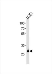 Anti-CNOT8 antibody, C-term used in Western Blot (WB). GTX81874