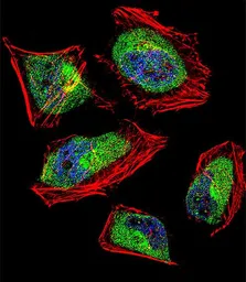 Anti-CNOT8 antibody, C-term used in Immunocytochemistry/ Immunofluorescence (ICC/IF). GTX81874