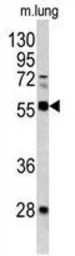 Anti-FLI1 antibody, Internal used in Western Blot (WB). GTX81878