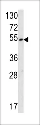 Anti-SUV4-20H2 antibody, Internal used in Western Blot (WB). GTX81881