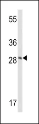Anti-Frataxin antibody, Internal used in Western Blot (WB). GTX81888