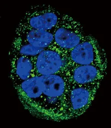 Anti-Frataxin antibody, Internal used in Immunocytochemistry/ Immunofluorescence (ICC/IF). GTX81888