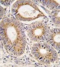 Anti-FGF1 antibody, N-term used in IHC (Paraffin sections) (IHC-P). GTX81891
