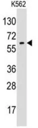 Anti-Glypican 6 antibody, N-term used in Western Blot (WB). GTX81897