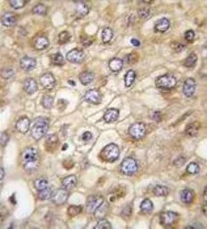 Anti-Claudin 2 antibody, N-term used in IHC (Paraffin sections) (IHC-P). GTX81901